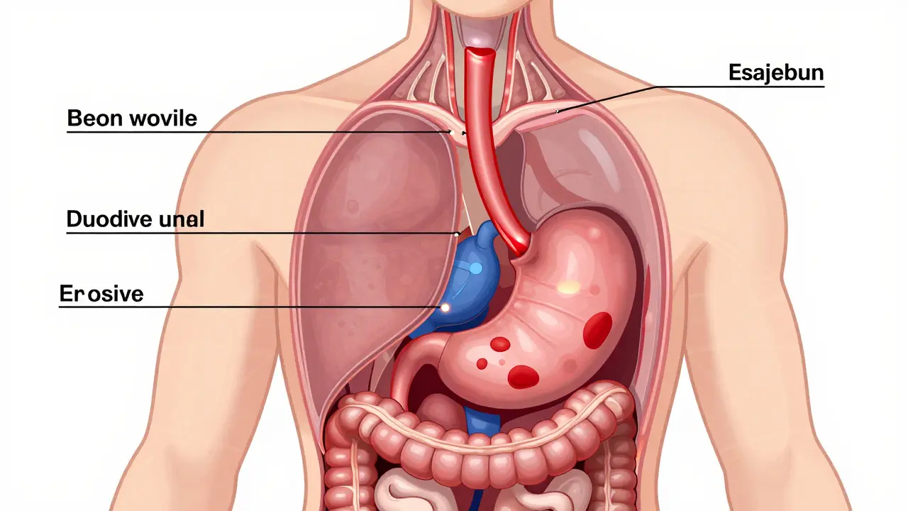 Upper GI Bleeding: Ulcers, Varices, and How to Stabilize Quickly